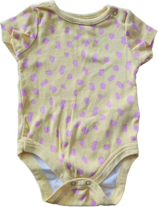 Onesie